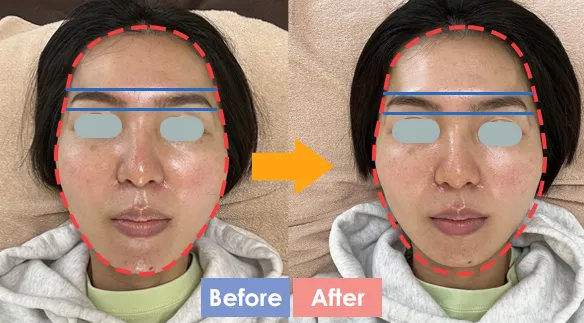 顎関節症・小顔を治す頭蓋骨矯正のエクラリー