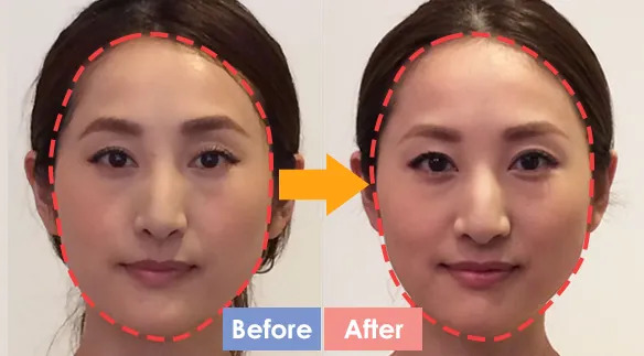 「小顔矯正・アンチエイジング」頭蓋骨矯正専門のエクラリー