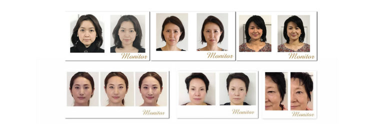 エクラリー　Eclary 　矯正の効果