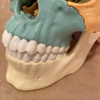歯列矯正と頭蓋骨矯正の関係性